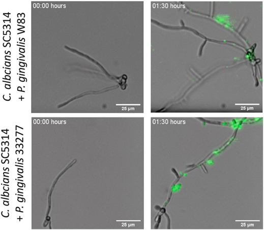 Porphyromonas gingivalis interaction with Candida albicans allows for aerobic escape virulence and