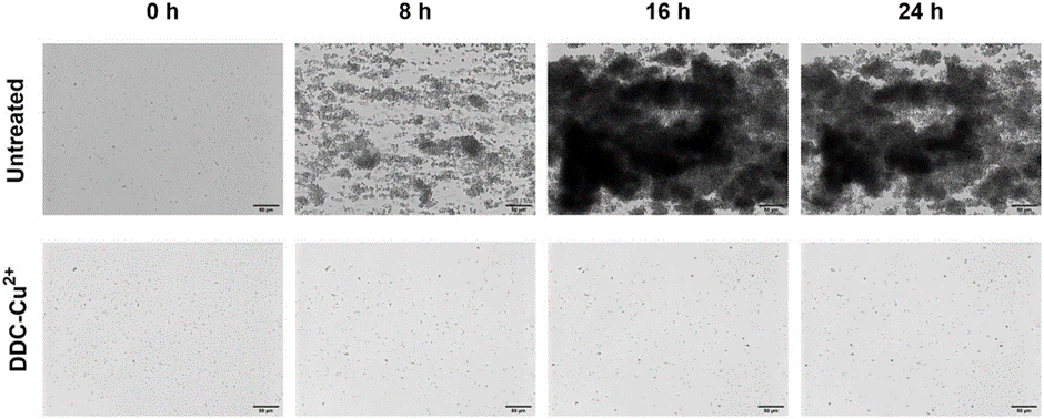 The combination of diethyldithiocarbamate and copper ions is active against Staphylococcus aureus and