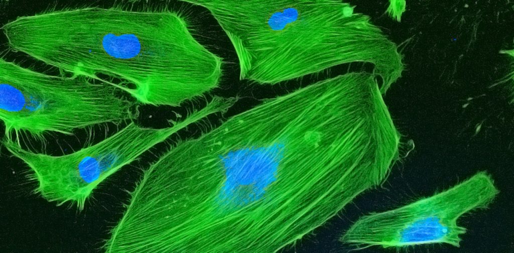 Confocal HUVEC