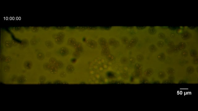 biofilm acidification