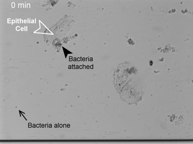 biofilm growth on