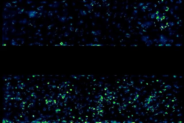 leukocyte adhesion hires