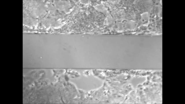 tremblay et al escherichia coli